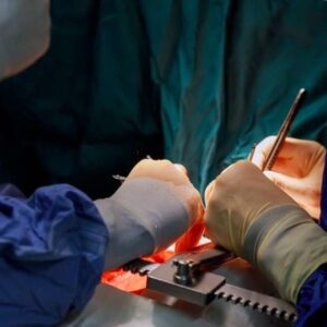 Inovações no Campo de Transplantes Cardíacos - O Uso de Inteligência Artificial e Órgãos Animais